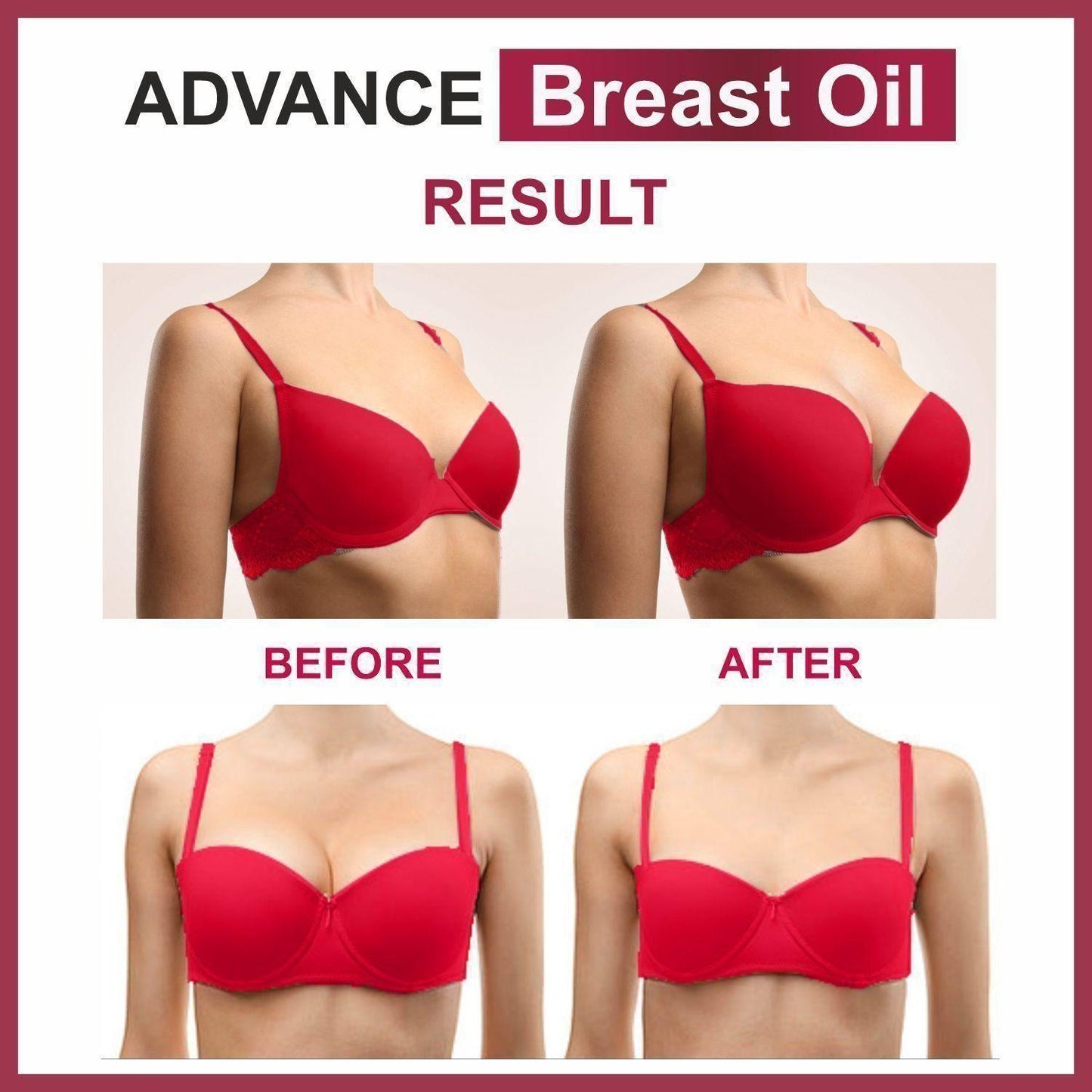 Ollanic Advance Breast Oil Combo 30ml Each